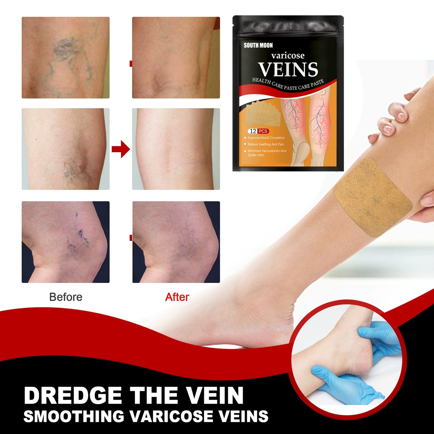 Venous Health Patch Relieves Variant Feet Vein Health Care Sticker