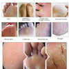 Lavendel Fußmaske Peeling Socken 1 Paar Lavendel Fußmaske Peeling