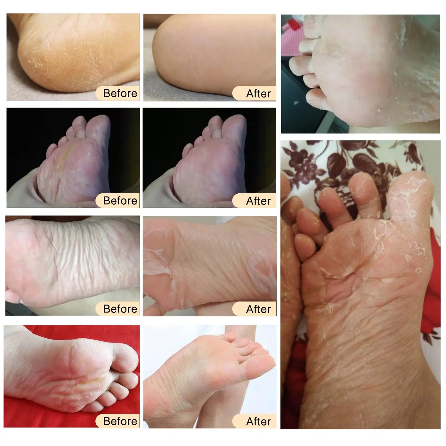 Foot Peel Mask, Exfoliating Peel Off Calluses Dead Skin Callus Remover Dry Cracked Feet, Baby Soft Smooth Touch Feet Skin