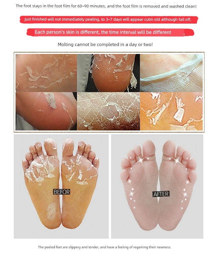 Südkorea Die Enjia Doppelt Peeling Fußmaske gegen abgestorbene Haut und Schwielen Feuchtigkeitsspendend Zarte weiße Füße Sohlenpflege Fußmaske