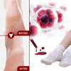 Foot Peeling Mask Peeling Foot Mask Repairs Heels & Removes Dry Dead Skin Feet Exfoliating Foot Peel Mask for Dry Cracked Feet