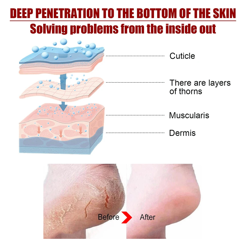 Foot Peel Mask, Exfoliating Peel Off Calluses Dead Skin Callus Remover Dry Cracked Feet, Baby Soft Smooth Touch Feet Skin