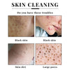 2/4PCS Kojisäureseife Gesichts- und Körperpflege Handgemachte Seife für Frauen Männer Gesichtschaum Reinigend Feuchtigkeitsspendend Aufhellende Seife Beauty-Tools