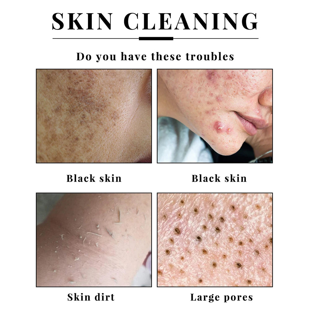 2/4PCS Kojisäureseife Gesichts- und Körperpflege Handgemachte Seife für Frauen Männer Gesichtschaum Reinigend Feuchtigkeitsspendend Aufhellende Seife Beauty-Tools